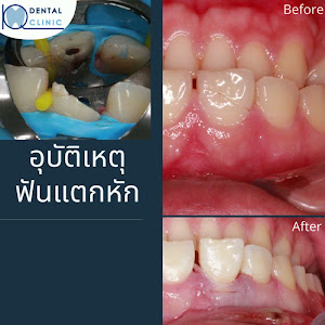 คลินิกทันตกรรมไอคิว ปทุมธานี (IQ Dental Clinic) — photo 3