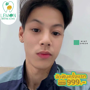 LEMON Dental Clinic (สาขาบางใหญ่ซิตี้) จัดฟัน ทำฟัน - เลมอน คลินิกทันตกรรม — exterior