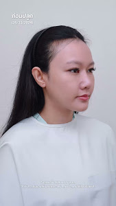 BLS hair center (ศูนย์ปลูกผม บีแอลเอส) — photo 3