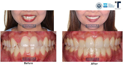 Doctor T Dental Clinic จัดฟัน เฉพาะทางจากอเมริกา American Board Certified
