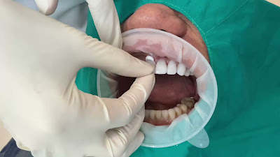 Smile and Style dental studio - ทำฟัน จัดฟัน วีเนียร์ รากเทียม ทันตกรรมครบวงจร — photo 3