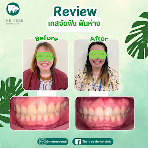 The Tree Dental Clinic บางพลี — photo 3