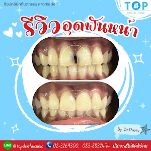 ท๊อปทันตกรรมลาดกระบัง — photo 3